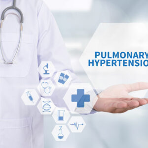 Pulmonary arterial hypertension – Causes, symptoms, and preventive measures