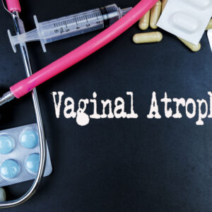 Vaginal Atrophy Treatment – An Overview